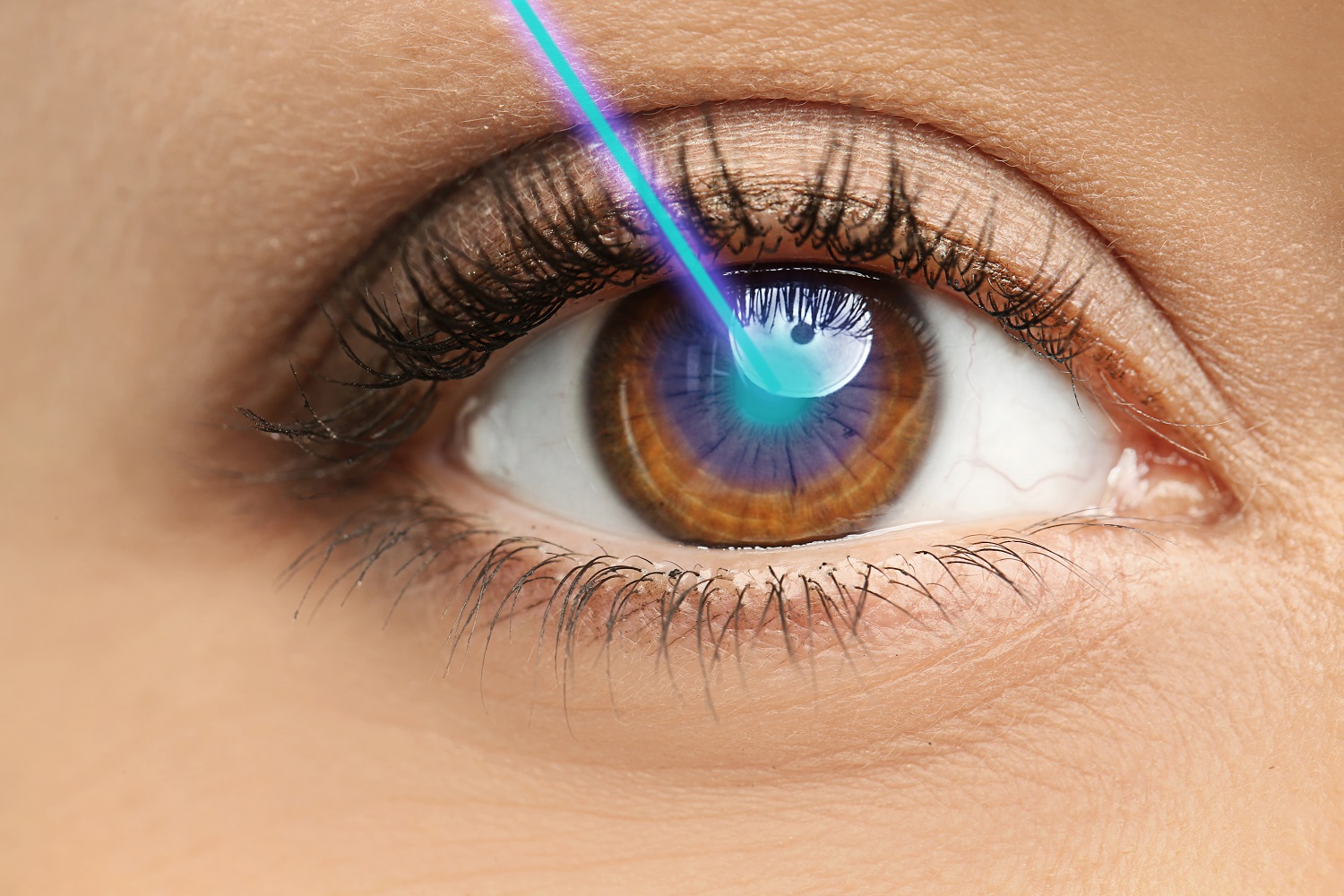 A brief guide on laser eye surgery